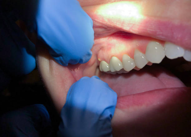 Best After-Hours Emergency Dentist in Cornwells Heights, PA